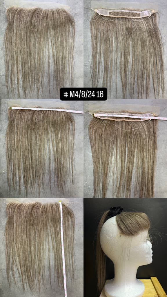 GHC FFA Piece - Frontal Fibrosing Alopecia